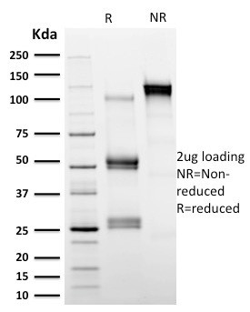 Calpastatin Antibody in SDS-PAGE (SDS-PAGE)