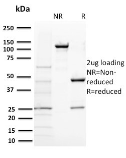 BAP1 (BRCA1 Associated Protein 1) Antibody in SDS-PAGE (SDS-PAGE)