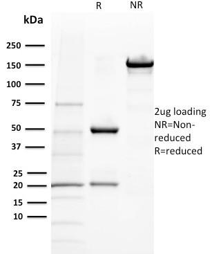 BAP1 (BRCA1 Associated Protein 1) Antibody in SDS-PAGE (SDS-PAGE)