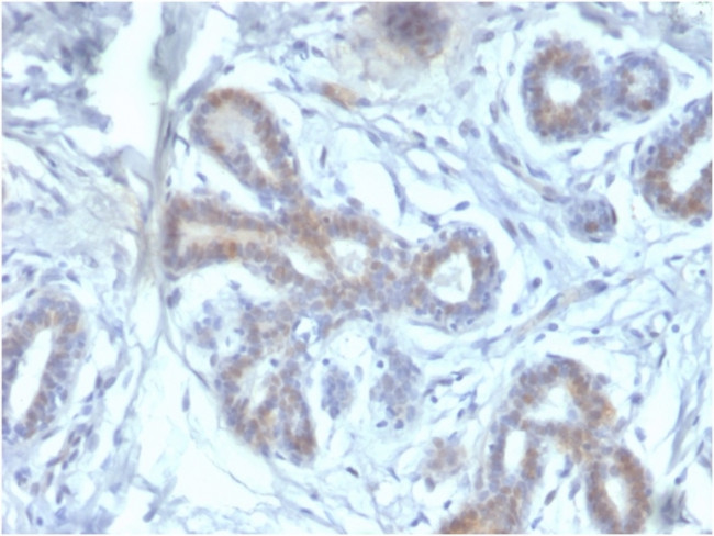 BAP1 (BRCA1 Associated Protein 1) Antibody in Immunohistochemistry (Paraffin) (IHC (P))