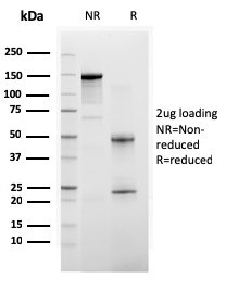 BAP1 (BRCA1 Associated Protein 1) Antibody in SDS-PAGE (SDS-PAGE)