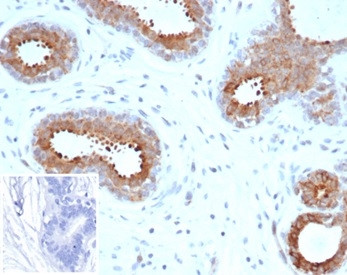 BAP1 (BRCA1 Associated Protein 1) Antibody in Immunohistochemistry (Paraffin) (IHC (P))