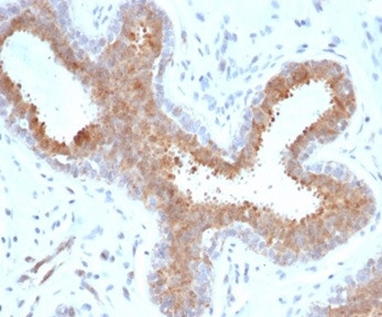 BAP1 (BRCA1 Associated Protein 1) Antibody in Immunohistochemistry (Paraffin) (IHC (P))