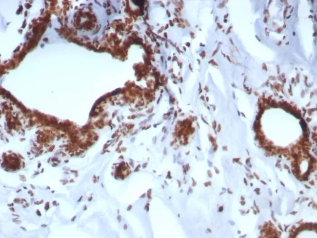 BAP1 (BRCA1 Associated Protein 1) Antibody in Immunohistochemistry (Paraffin) (IHC (P))