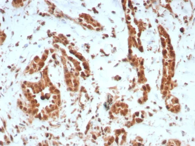 BAP1 (BRCA1 Associated Protein 1) Antibody in Immunohistochemistry (Paraffin) (IHC (P))