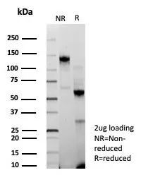 BAP1 (BRCA1 Associated Protein 1) Antibody in Immunohistochemistry (Paraffin) (IHC (P))