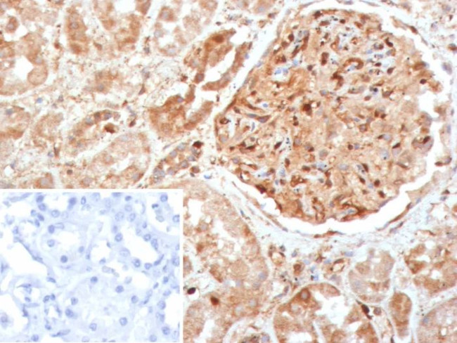 CASP7/Caspase-7 Antibody in Immunohistochemistry (Paraffin) (IHC (P))