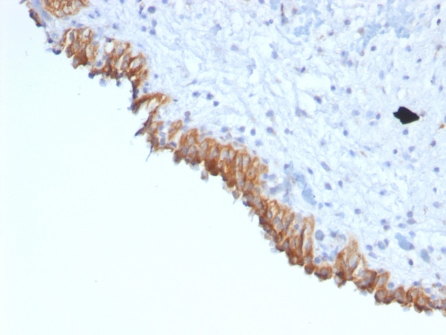 MAML2 (Mastermind Like Transcriptional Coactivator 2) Antibody in Immunohistochemistry (Paraffin) (IHC (P))