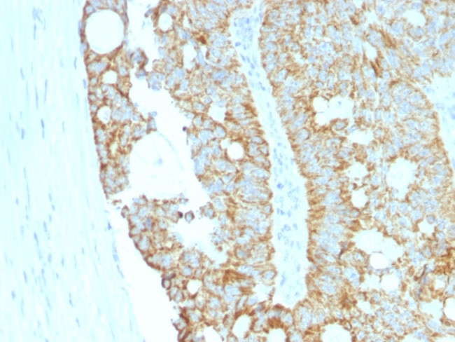 MAML2 (Mastermind Like Transcriptional Coactivator 2) Antibody in Immunohistochemistry (Paraffin) (IHC (P))