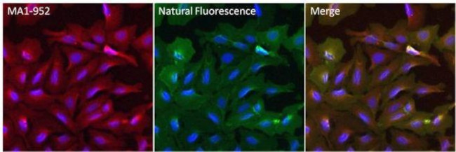 Mouse IgG (H+L) Secondary Antibody in Immunocytochemistry (ICC/IF)