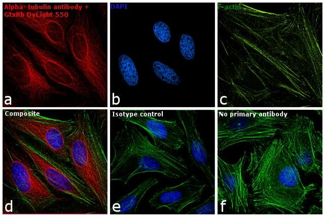 Rabbit IgG (H+L) Secondary Antibody in Immunocytochemistry (ICC/IF)