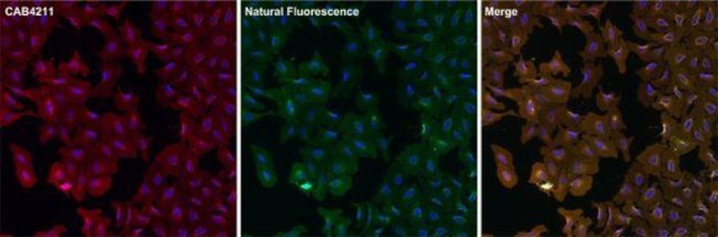 Rabbit IgG (H+L) Secondary Antibody in Immunocytochemistry (ICC/IF)