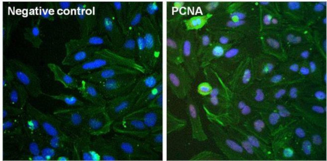 Mouse IgG (H+L) Secondary Antibody in Immunocytochemistry (ICC/IF)