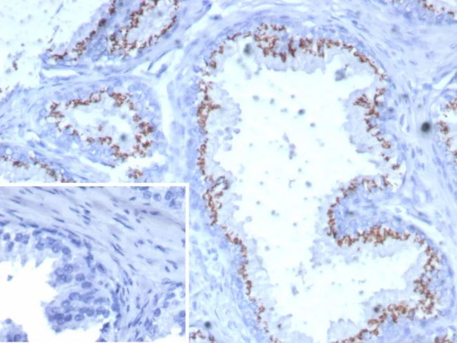 Prostein (p501S)/Solute Carrier Family 45 Member 3 (SLC45A3) Antibody in Immunohistochemistry (Paraffin) (IHC (P))