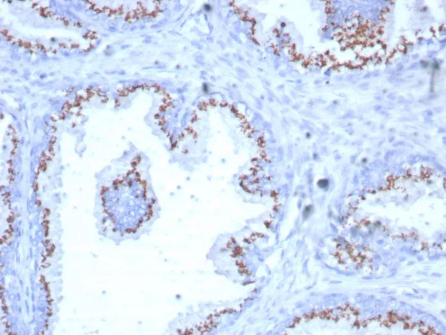 Prostein (p501S)/Solute Carrier Family 45 Member 3 (SLC45A3) Antibody in Immunohistochemistry (Paraffin) (IHC (P))