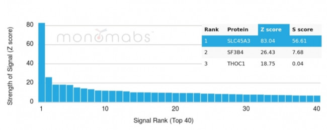 Prostein (p501S)/Solute Carrier Family 45 Member 3 (SLC45A3) Antibody in Peptide array (ARRAY)