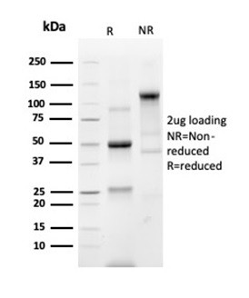 Prostein (p501S)/Solute Carrier Family 45 Member 3 (SLC45A3) Antibody in SDS-PAGE (SDS-PAGE)