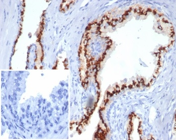 Prostein (p501S)/Solute Carrier Family 45 Member 3 (SLC45A3) Antibody in Immunohistochemistry (Paraffin) (IHC (P))