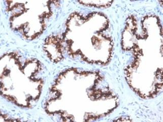 Prostein (p501S)/Solute Carrier Family 45 Member 3 (SLC45A3) Antibody in Immunohistochemistry (Paraffin) (IHC (P))