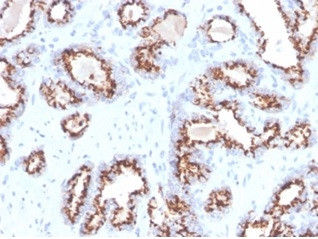 Prostein (p501S)/Solute Carrier Family 45 Member 3 (SLC45A3) Antibody in Immunohistochemistry (Paraffin) (IHC (P))