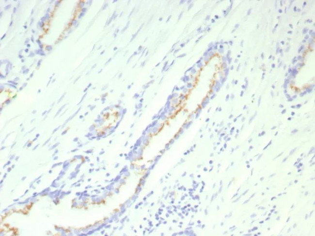 Prostein (p501S)/Solute Carrier Family 45 Member 3 (SLC45A3) Antibody in Immunohistochemistry (Paraffin) (IHC (P))