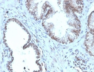 Prostein (p501S)/Solute Carrier Family 45 Member 3 (SLC45A3) Antibody in Immunohistochemistry (Paraffin) (IHC (P))