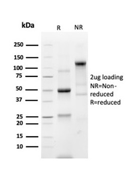 Prostein (p501S)/Solute Carrier Family 45 Member 3 (SLC45A3) Antibody in SDS-PAGE (SDS-PAGE)