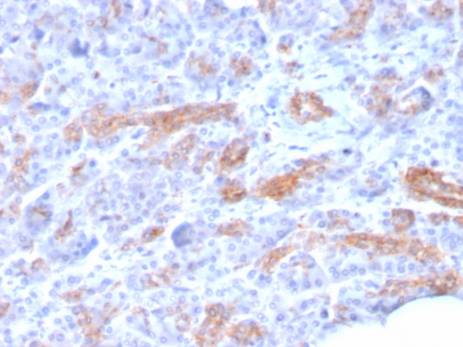 MRP3 (Multidrug Resistance-Associated Protein 3) Antibody in Immunohistochemistry (Paraffin) (IHC (P))