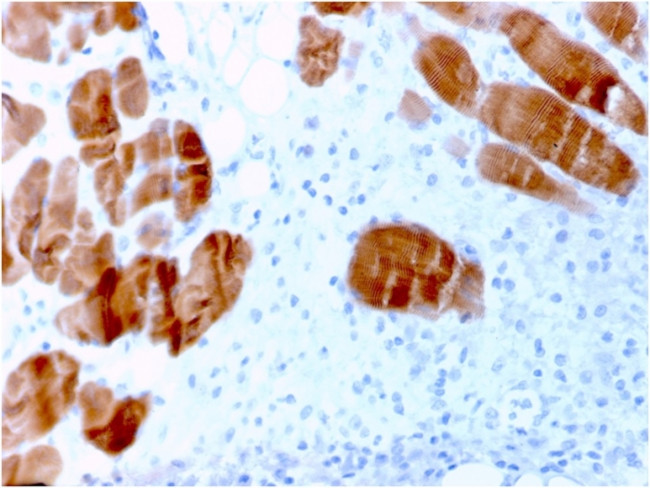 Sarcomeric Actinin Alpha 2/ACTN2 Antibody in Immunohistochemistry (Paraffin) (IHC (P))