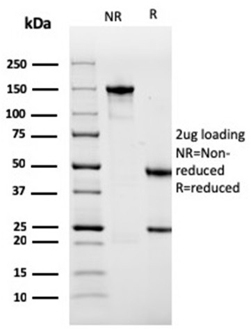 Sarcomeric Actinin Alpha 2/ACTN2 Antibody in SDS-PAGE (SDS-PAGE)