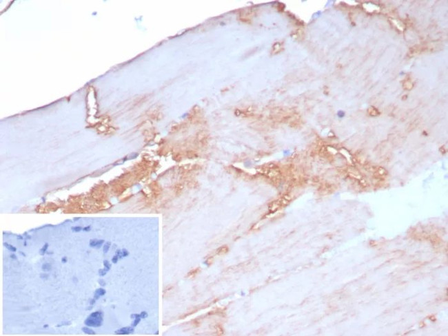 Sarcomeric Actinin Alpha 2/ACTN2 Antibody in Immunohistochemistry (Paraffin) (IHC (P))