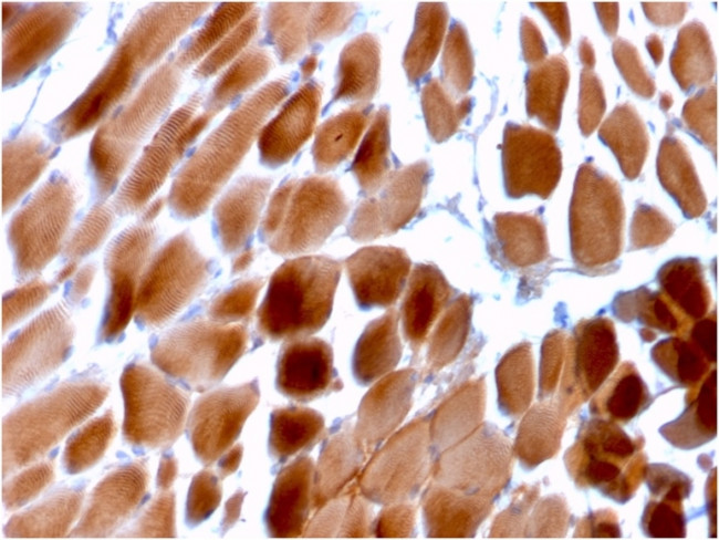 Sarcomeric Actinin Alpha 2/ACTN2 Antibody in Immunohistochemistry (Paraffin) (IHC (P))