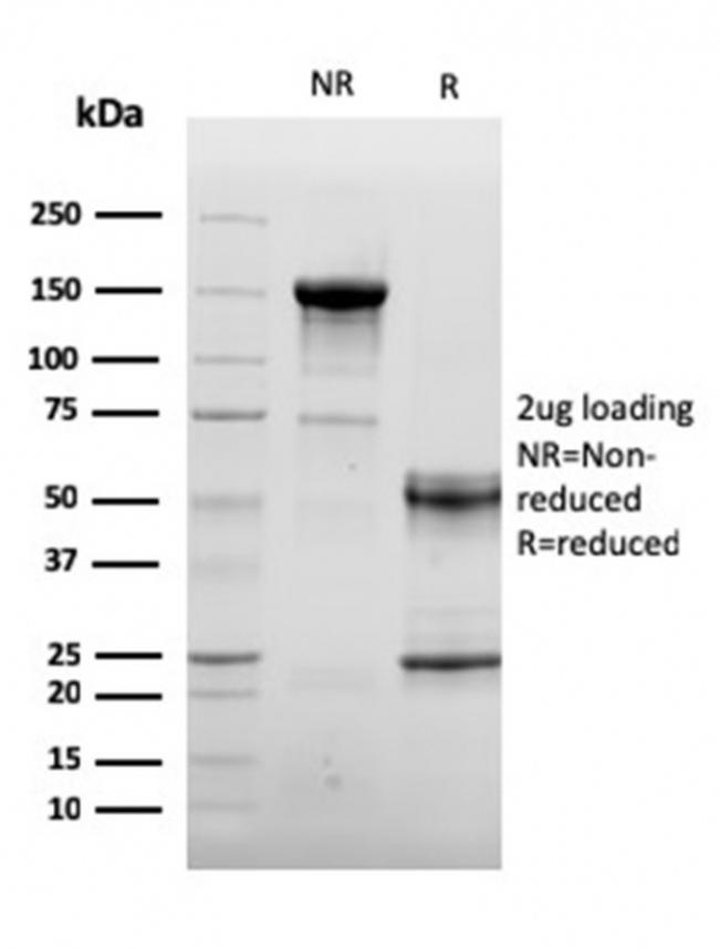 Sarcomeric Actinin Alpha 2/ACTN2 Antibody in SDS-PAGE (SDS-PAGE)