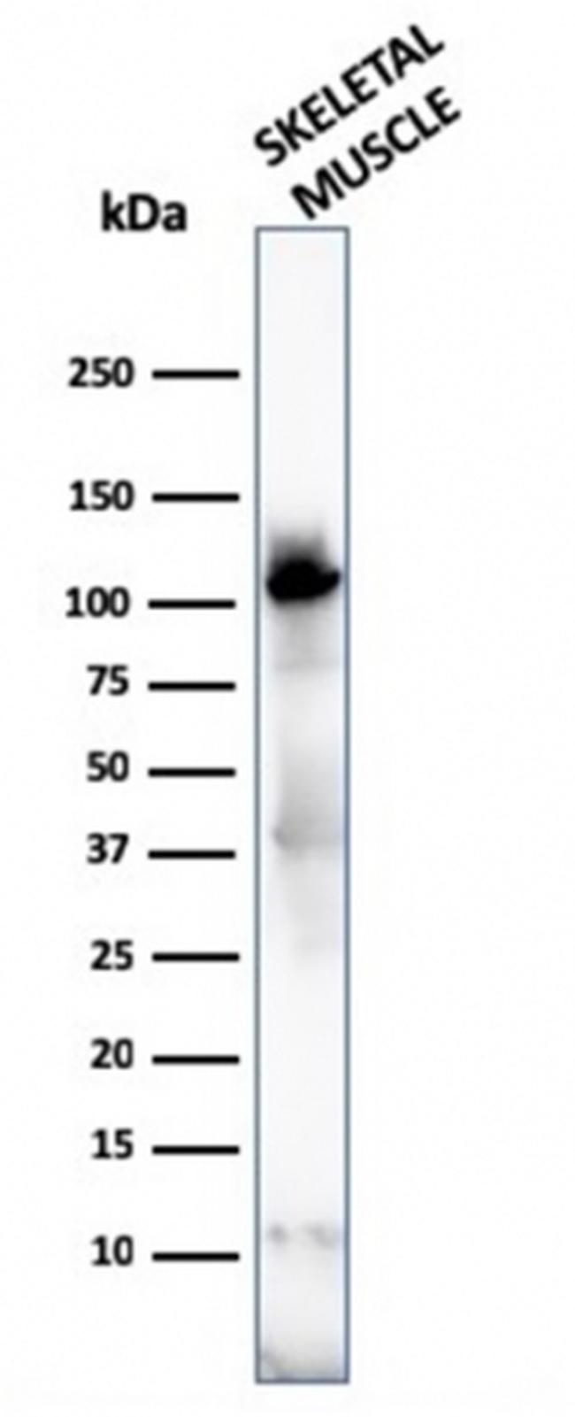 Sarcomeric Actinin Alpha 2/ACTN2 Antibody in Western Blot (WB)
