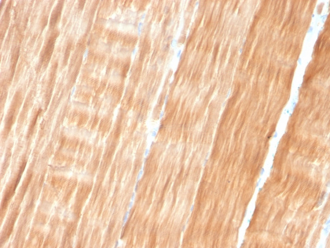 Sarcomeric Actinin Alpha 2/ACTN2 Antibody in Immunohistochemistry (Paraffin) (IHC (P))