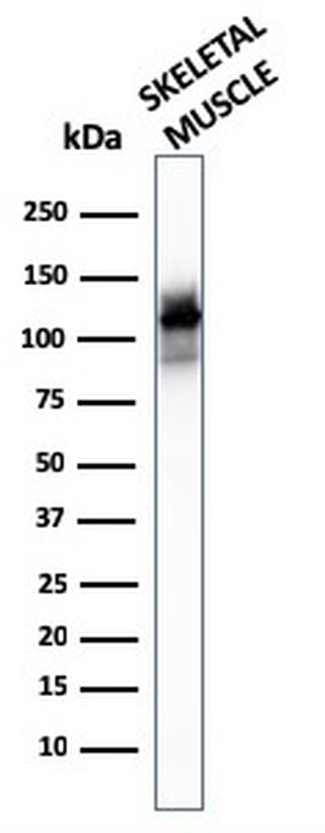 Sarcomeric Actinin Alpha 2/ACTN2 Antibody in Western Blot (WB)