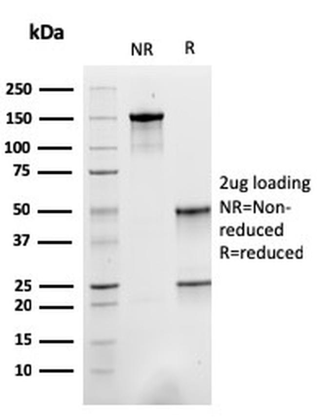 Sarcomeric Actinin Alpha 2/ACTN2 Antibody in SDS-PAGE (SDS-PAGE)