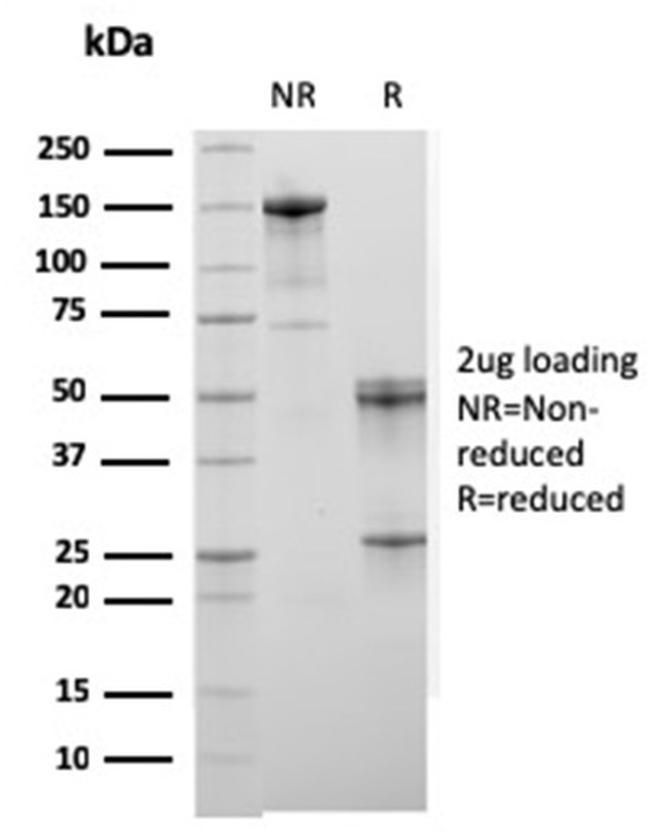 Sarcomeric Actinin Alpha 2/ACTN2 Antibody in SDS-PAGE (SDS-PAGE)