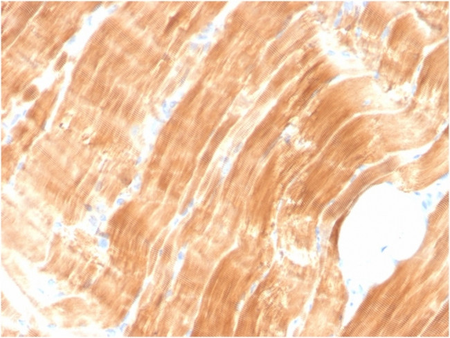 Sarcomeric Actinin Alpha 2/ACTN2 Antibody in Immunohistochemistry (Paraffin) (IHC (P))