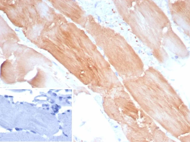 Sarcomeric Actinin Alpha 2/ACTN2 Antibody in Immunohistochemistry (Paraffin) (IHC (P))