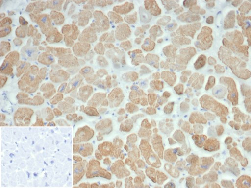 Sarcomeric Actinin Alpha 2/ACTN2 Antibody in Immunohistochemistry (Paraffin) (IHC (P))