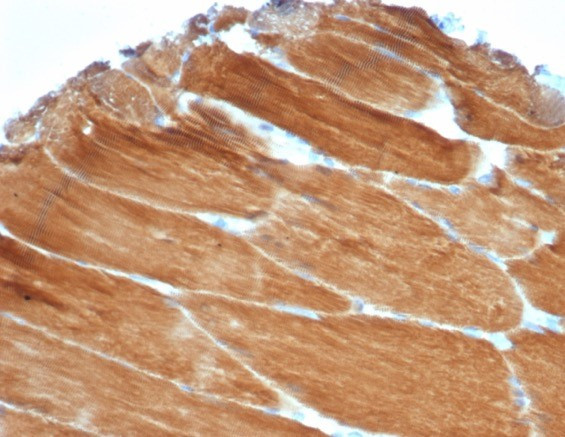 Sarcomeric Actinin Alpha 2/ACTN2 Antibody in Immunohistochemistry (Paraffin) (IHC (P))