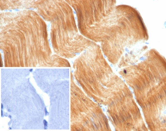 Sarcomeric Actinin Alpha 2/ACTN2 Antibody in Immunohistochemistry (Paraffin) (IHC (P))