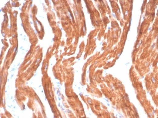 Sarcomeric Actinin Alpha 2/ACTN2 Antibody in Immunohistochemistry (Paraffin) (IHC (P))