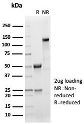 Sarcomeric Actinin Alpha 2/ACTN2 Antibody in SDS-PAGE (SDS-PAGE)