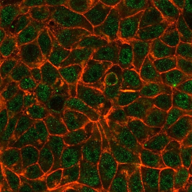 TRIM24/TIF1 alpha Antibody in Immunocytochemistry (ICC/IF)