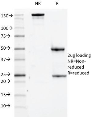 CD84/SLAMF5 Antibody in SDS-PAGE (SDS-PAGE)