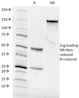 CD84/SLAMF5 Antibody in SDS-PAGE (SDS-PAGE)