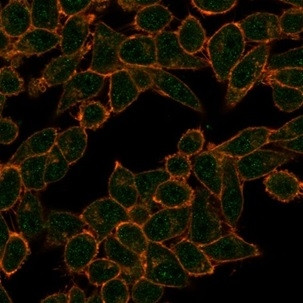 Histone Deacetylase 1 (HDAC3) Antibody in Immunocytochemistry (ICC/IF)