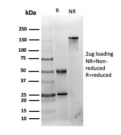 Histone Deacetylase 1 (HDAC3) Antibody in SDS-PAGE (SDS-PAGE)
